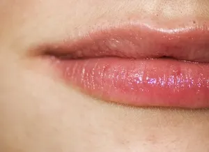 Upper lip Upper lip