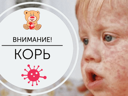 ОСТОРОЖНО - КОРЬ!