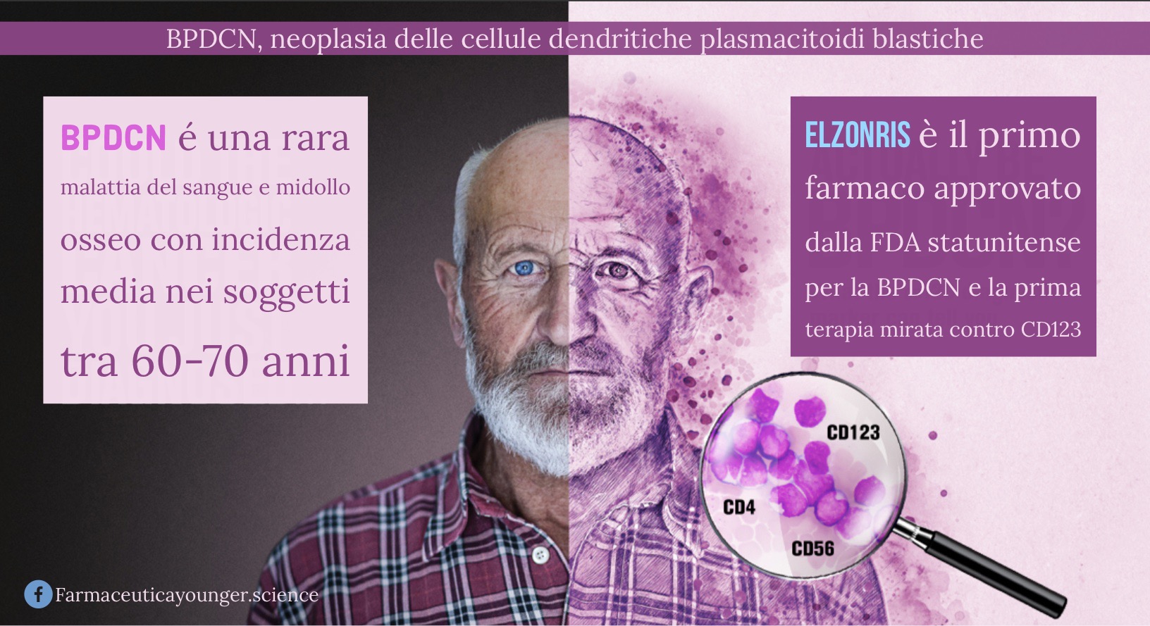 Elzonris, primo farmaco orfano approvato dalla FDA per la BPDCN