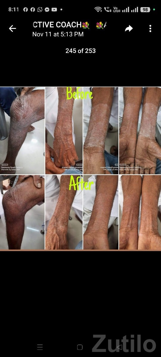 Weight Loss & Health Improvement Product - Beautician & Salon - Mendarda - Image 3