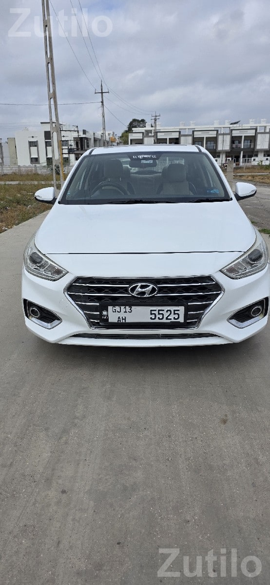 2018 Hyundai Verna SX O Diesel White 2018 Hyundai Verna SX O Diesel White