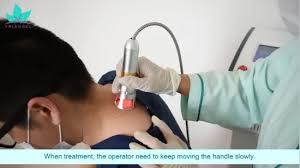 Cervical Spondylosis