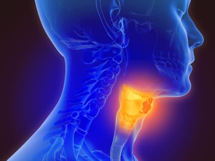 Хирург Паршин: Недолеченный ларингит может стать причиной рака трахеи