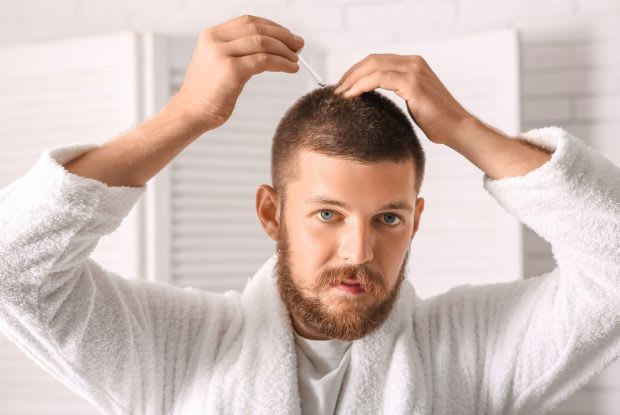 a man applying minoxidil to his scalp