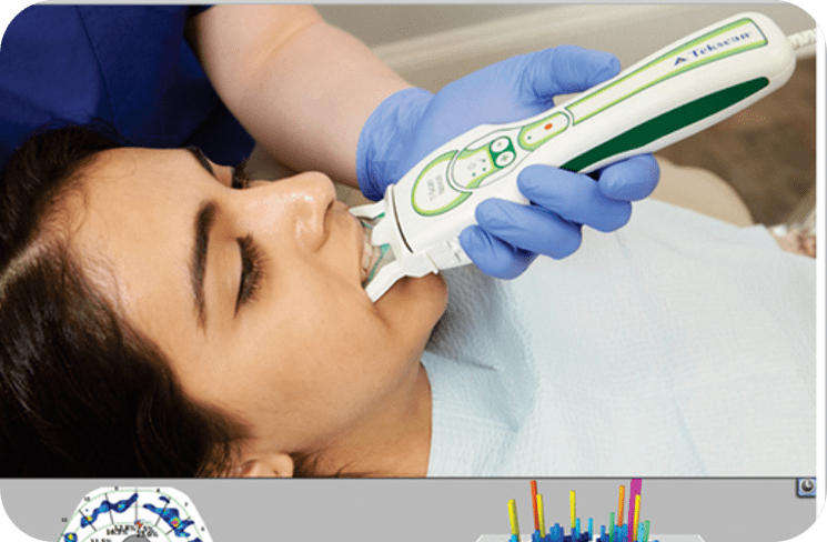 T-Scan Occlusal Analyzer
