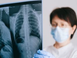 Hospital radiation protection equipment including shielding devices and safety gear