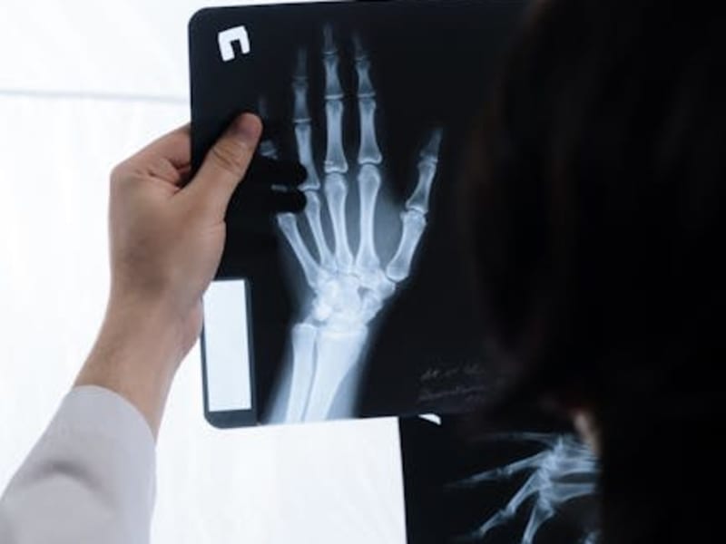Radiation protection gloves in use during fluoroscopy procedure