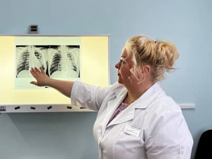 Почти полторы тысячи северян прошли обследование лёгких в рамках акции «Здоровое Поморье»