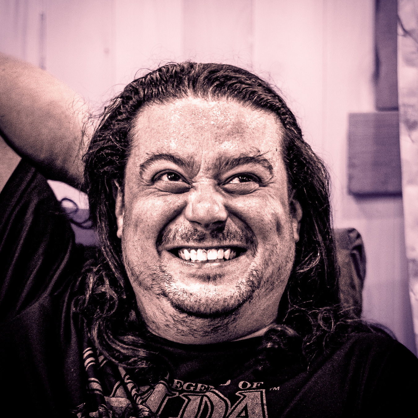 A portrait of a man that highlights his facial flaws