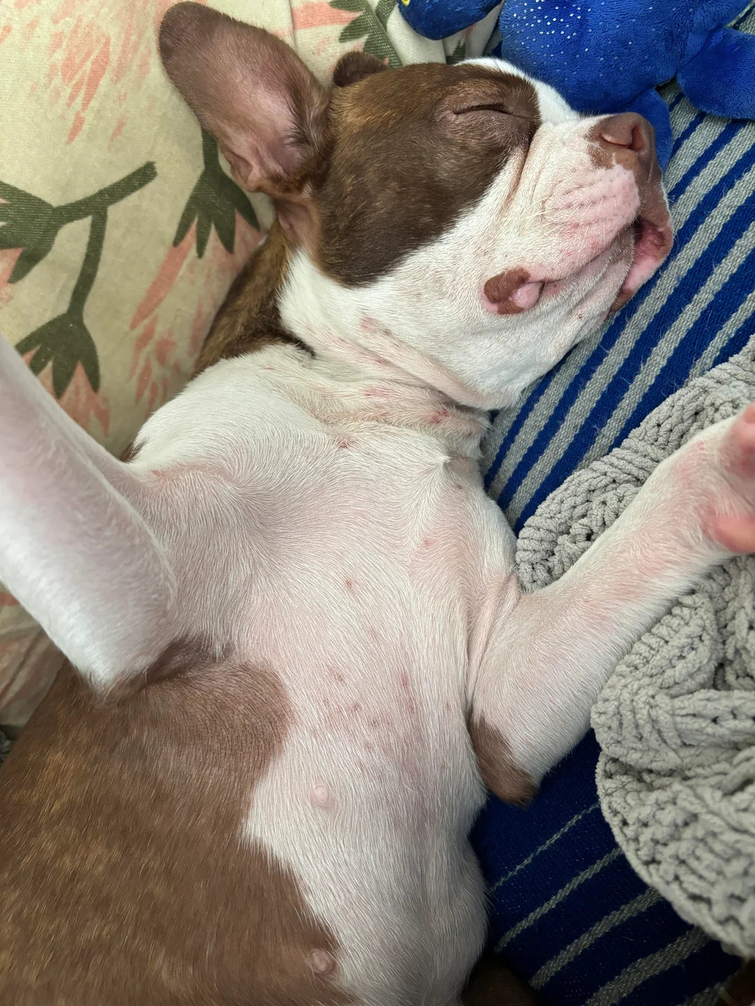 Extreme jeuk en huidirritatie