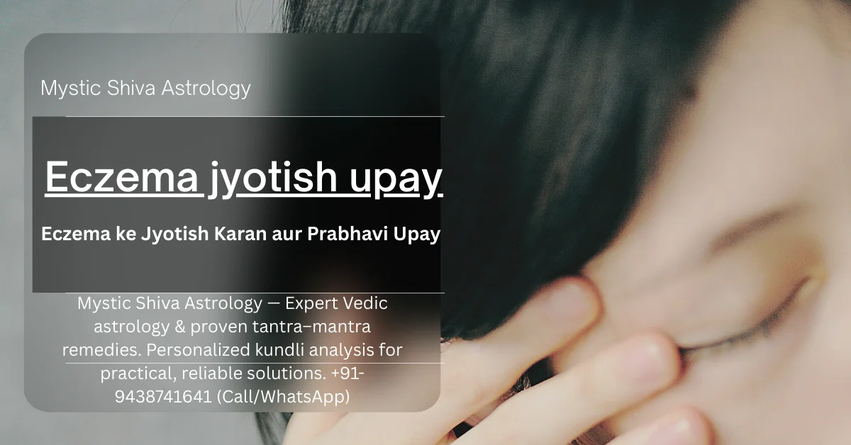 Eczema jyotish upay