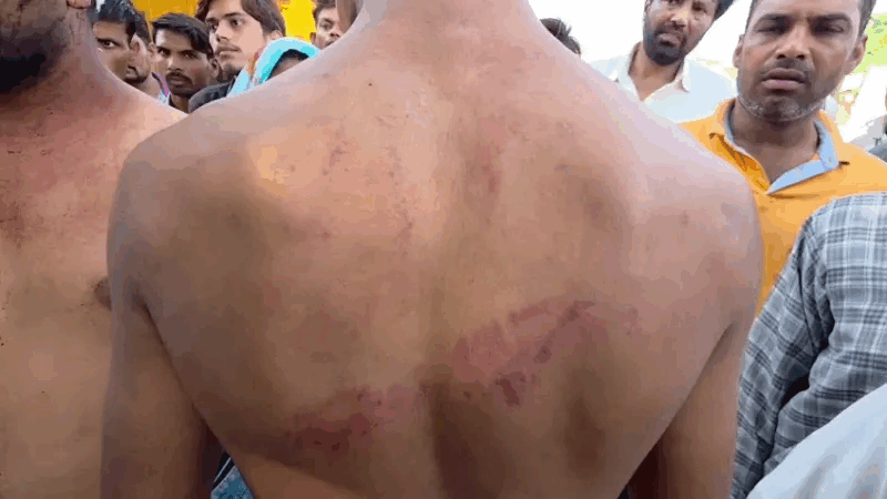 Alwar News | नगर निगम चुनाव के बीच वार्ड 43 में मारपीट : दो युवक घायल | भाजपा प्रत्याशी पर लगाया आरोप