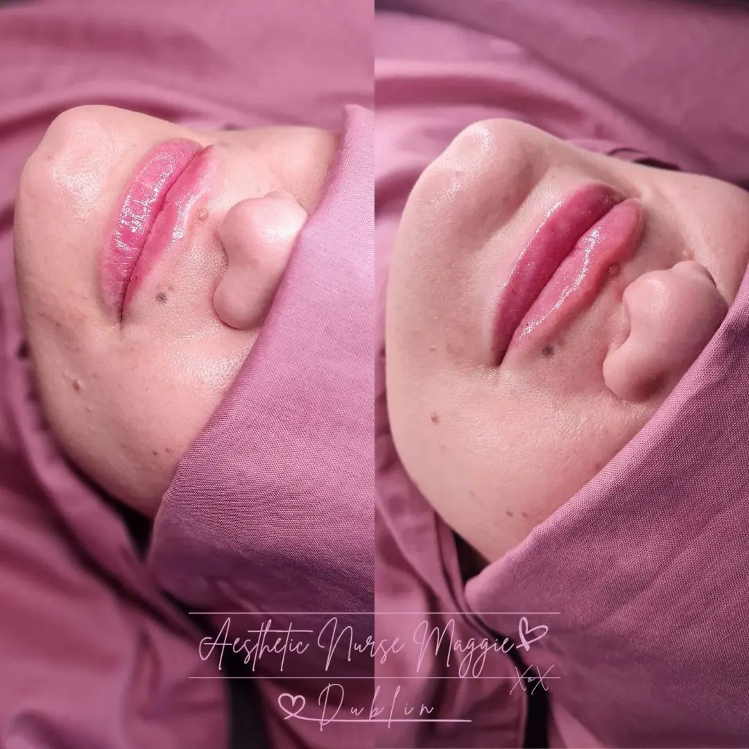 Treatment Result 8