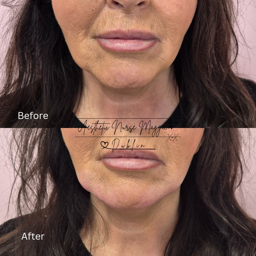 Treatment Result 10