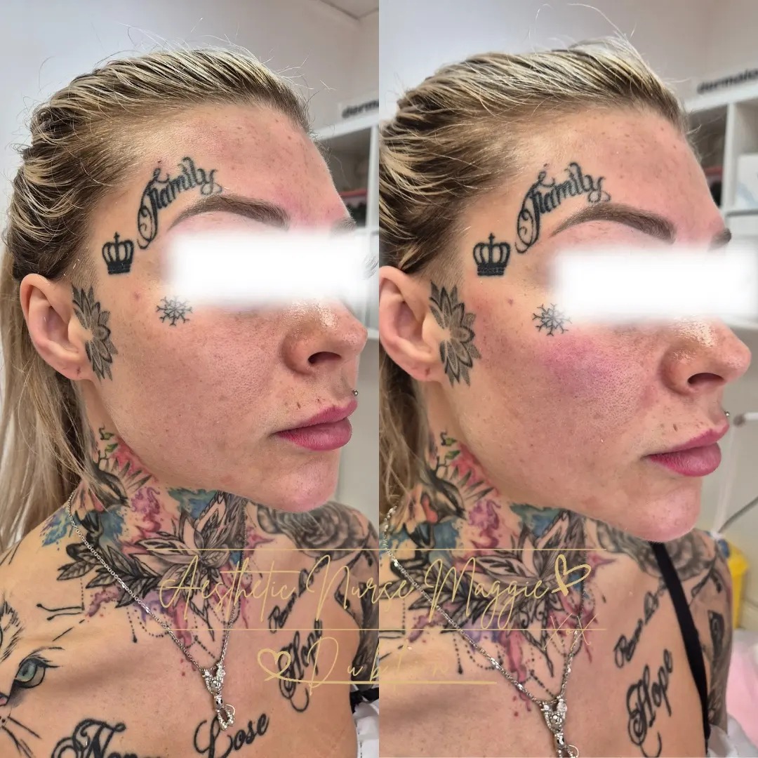 Treatment Result 7