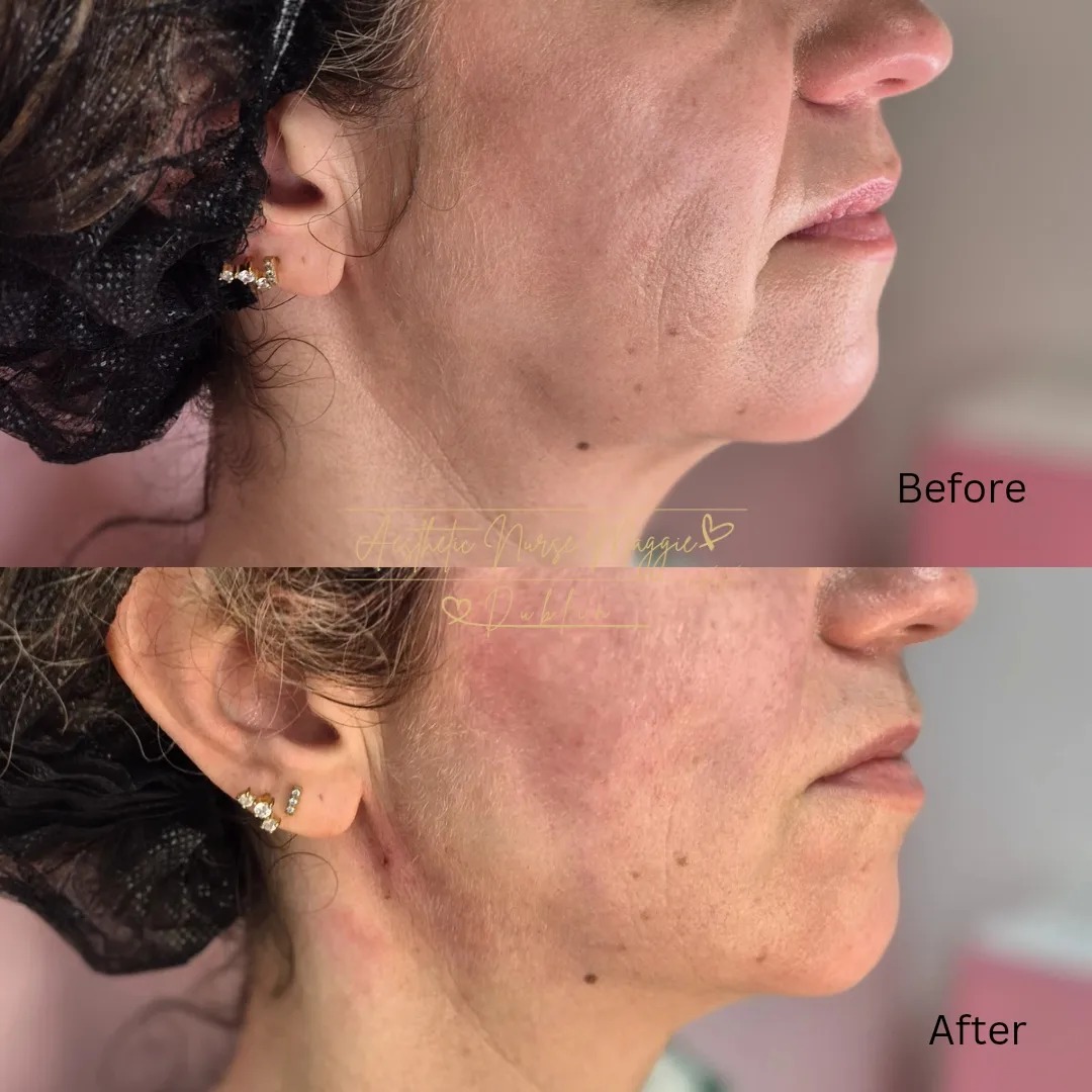 Treatment Result 6