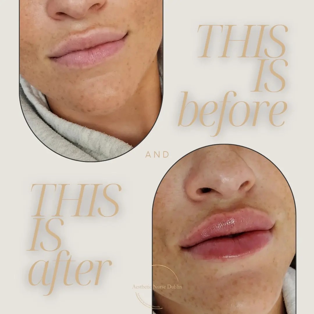 Treatment Result 5
