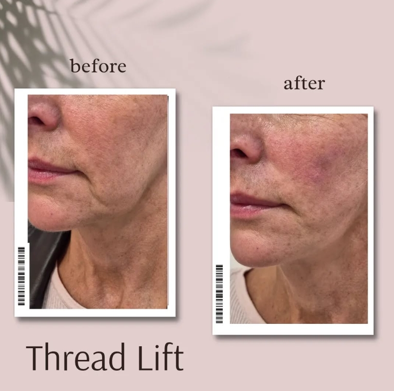 Before and After Treatment Result 3