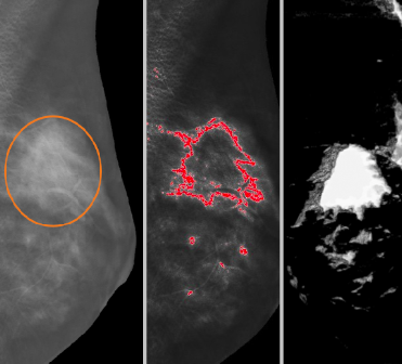 3D Image segmentation