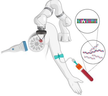 Ultrasound assisted Liquid Biopsy