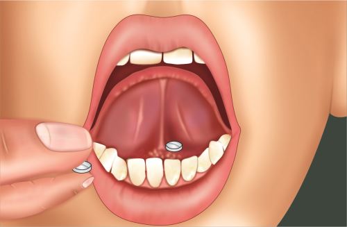 Metode Sublingual
