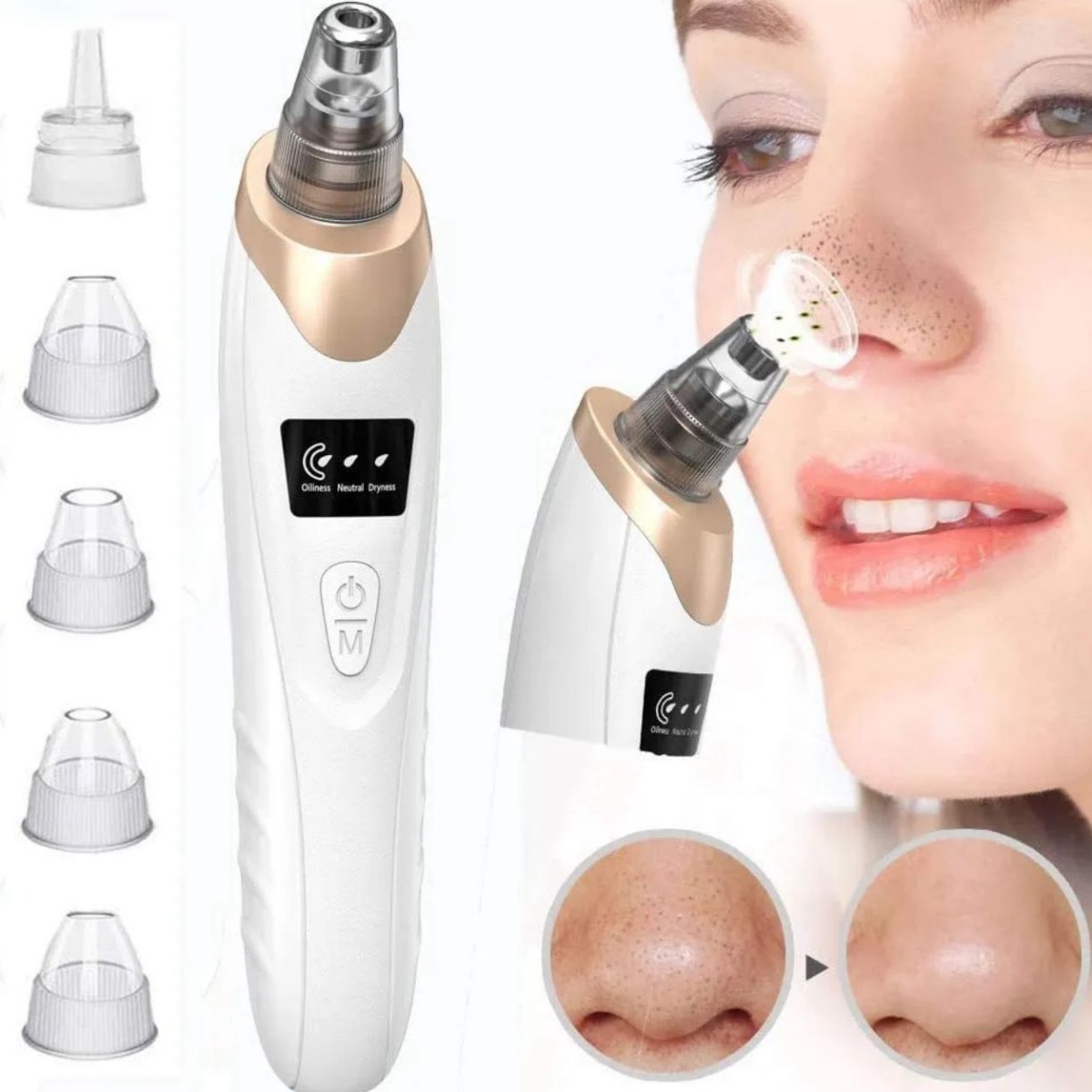 Multifunctional Electric Blackhead Remover and Pore Vacuum Machine