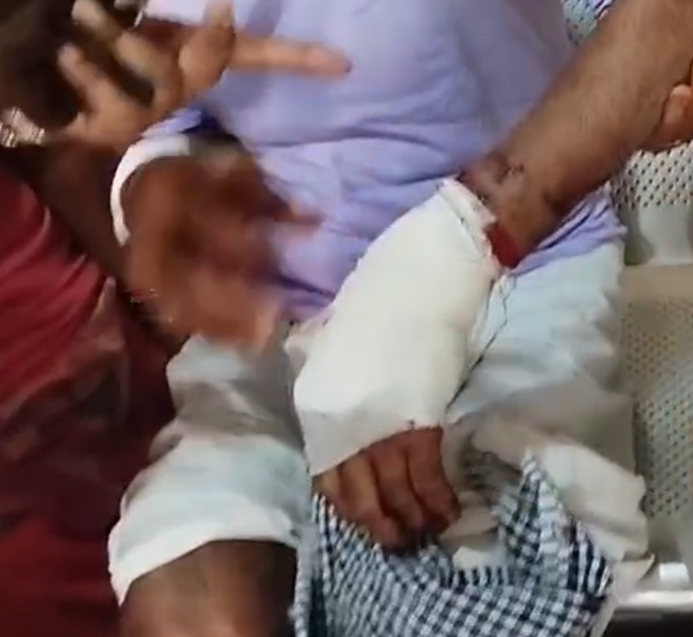 पागल कुत्ते ने मचाया आतंक