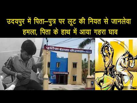 उदयपुर में पिता-पुत्र पर लूट की नियत से जानलेवा हमला, पिता के हाथ में आया गहरा घाव