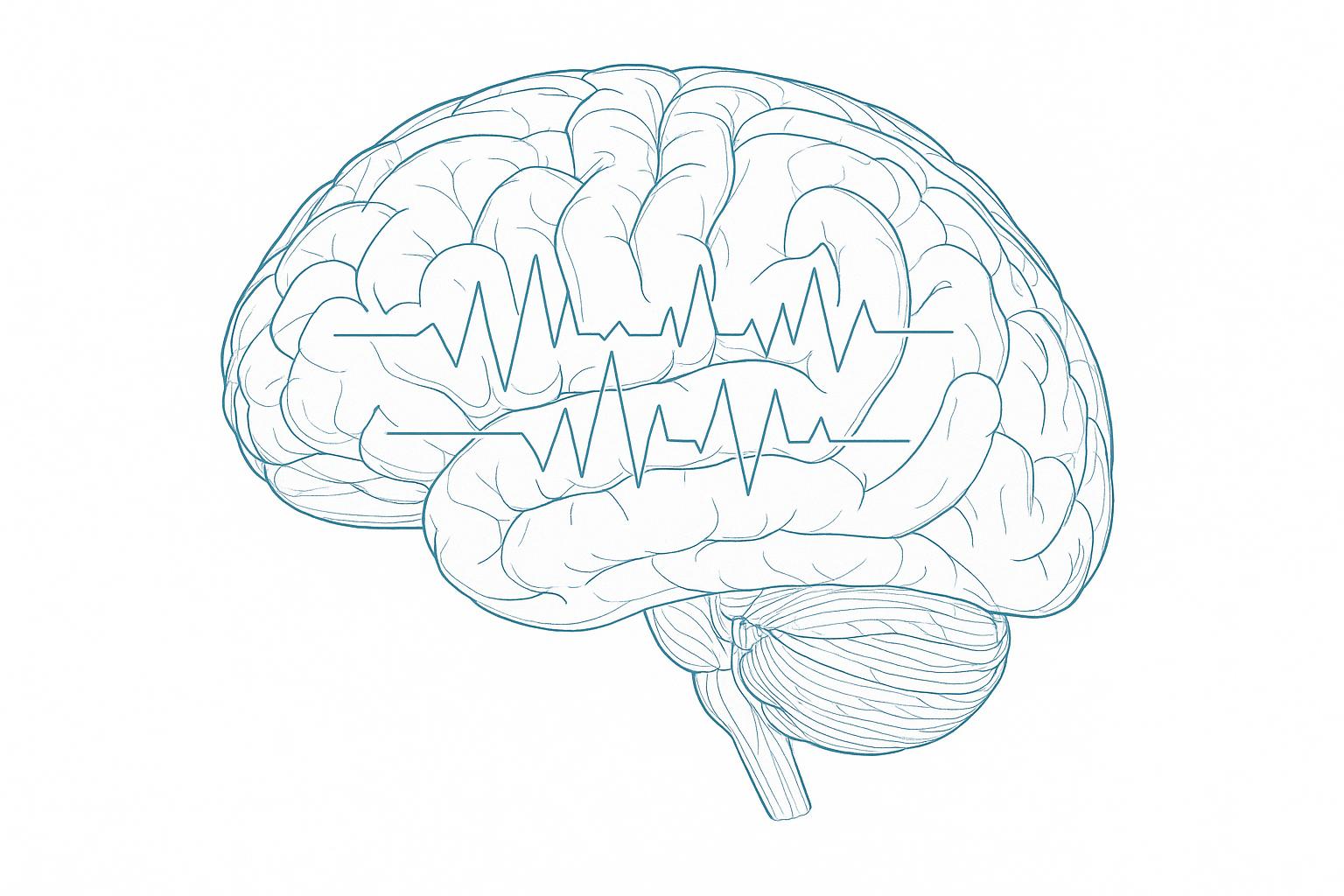 Microarousals