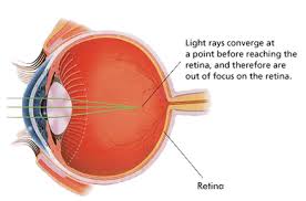 myopia kezelése az ájurvéda szerint)