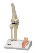 Mini Knee Joint with Cross Section