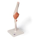 Functional Elbow Joint