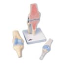 Sectional Knee Joint model, 3 part