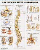 Human Spine Disorders Chart