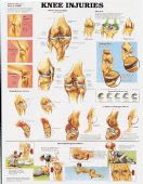 Knee Injuries Chart