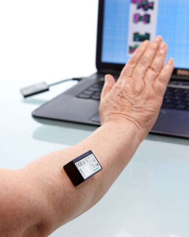 wireless_myo-ex_in_use_for_the_upper_extremity_(gx5)