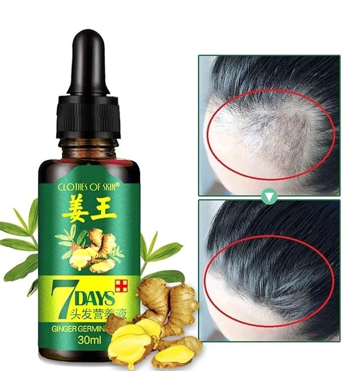 7 Day Ginger Germinal Serum Essence Oil Loss Treatment Growth Hair,Ginger Germinal Oil, Ginger Hair Growth Serum, Ginger Essential Oil