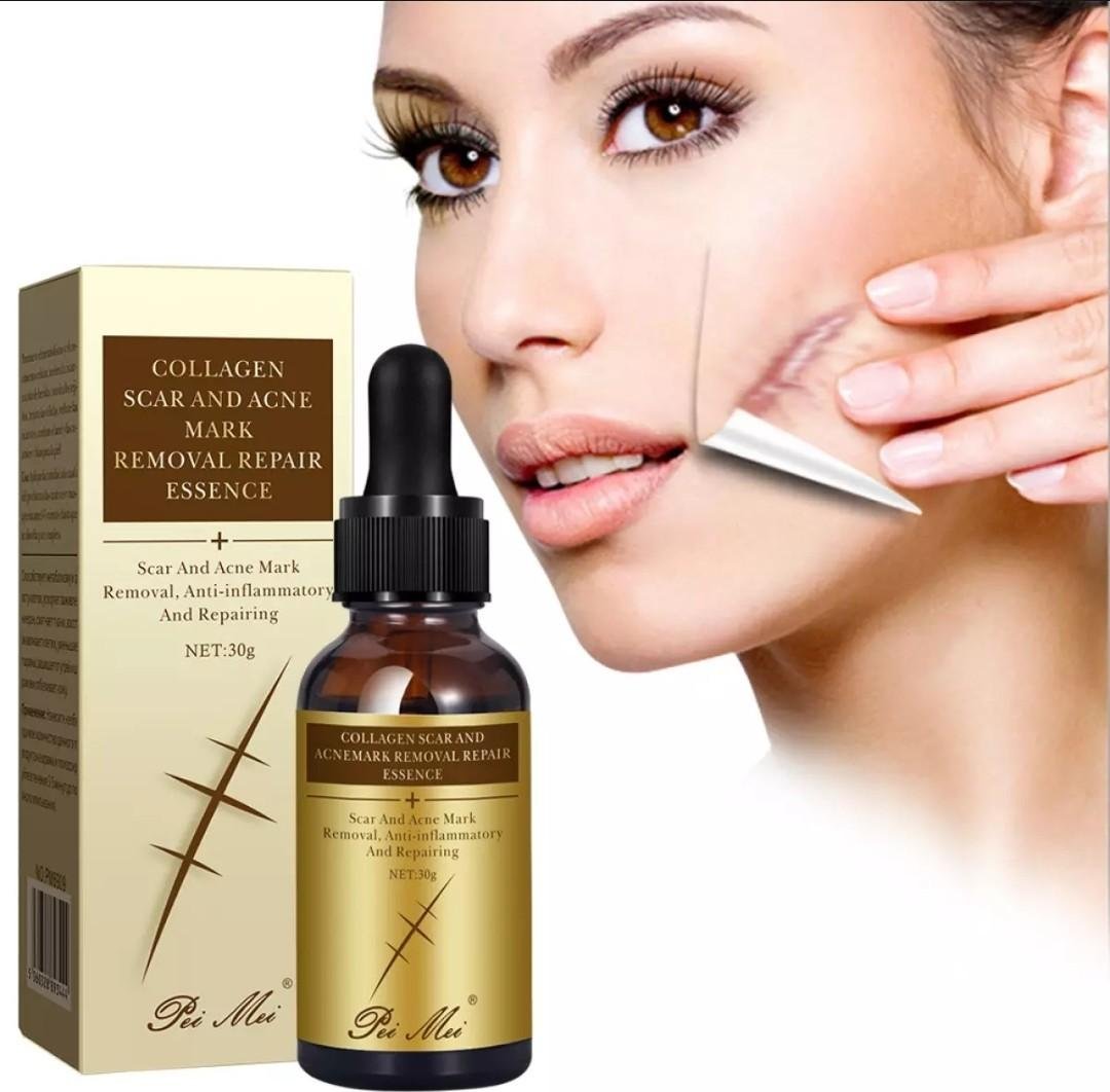 Collagen Scar & Acne Mark Removal Repair Essence