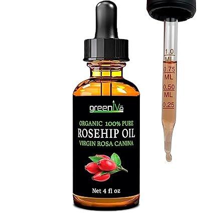 GreenIVe Rosehip Oil Rosa Canina 100% Pure Cold Pressed Virgin Oil Hair and Skin and DIY products (4oz dropper