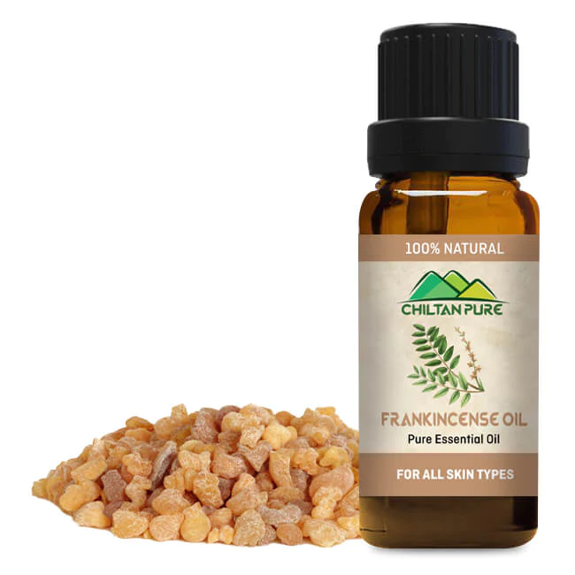 Frankincense Essential Oil – Best For Removing Dark Circles