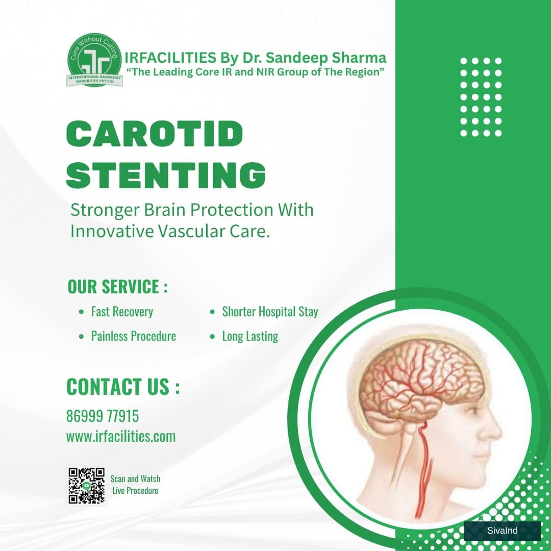 Carotid Artery Disease ICD 10 and Contemporary Treatment Approaches