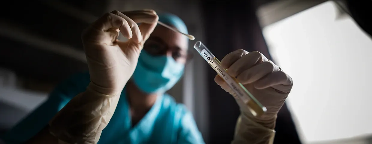 متطلبات فحص PCR لكوفيد 19 من أجل السفر