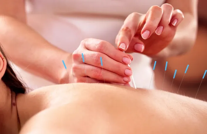 https://res.cloudinary.com/dbubjszto/image/upload/frhstagingweb/Dry_Needling_8b60042200.webp