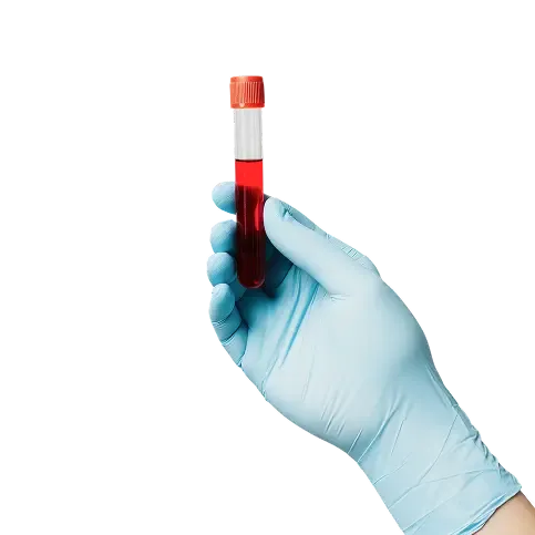 Lab Tests