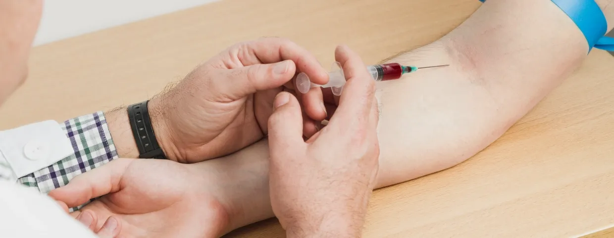 HIV At-Home Test: How They Work And What To Consider?