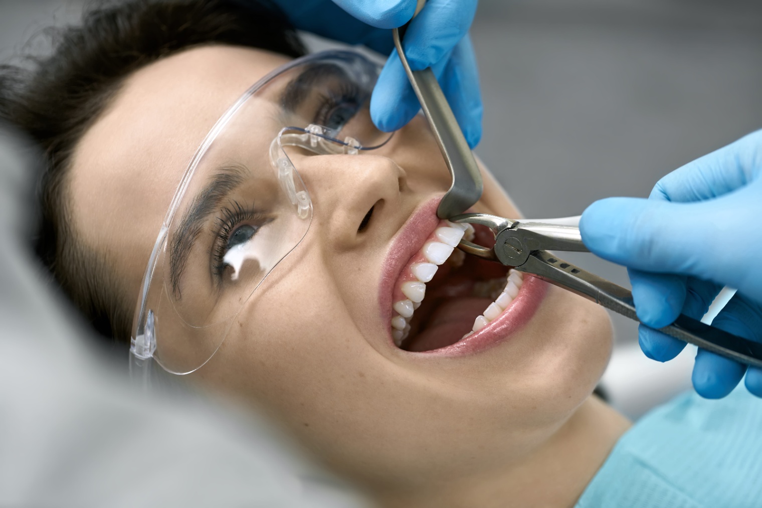 Do You Need a Tooth Extraction? 7 Signs You Shouldn’t Ignore
