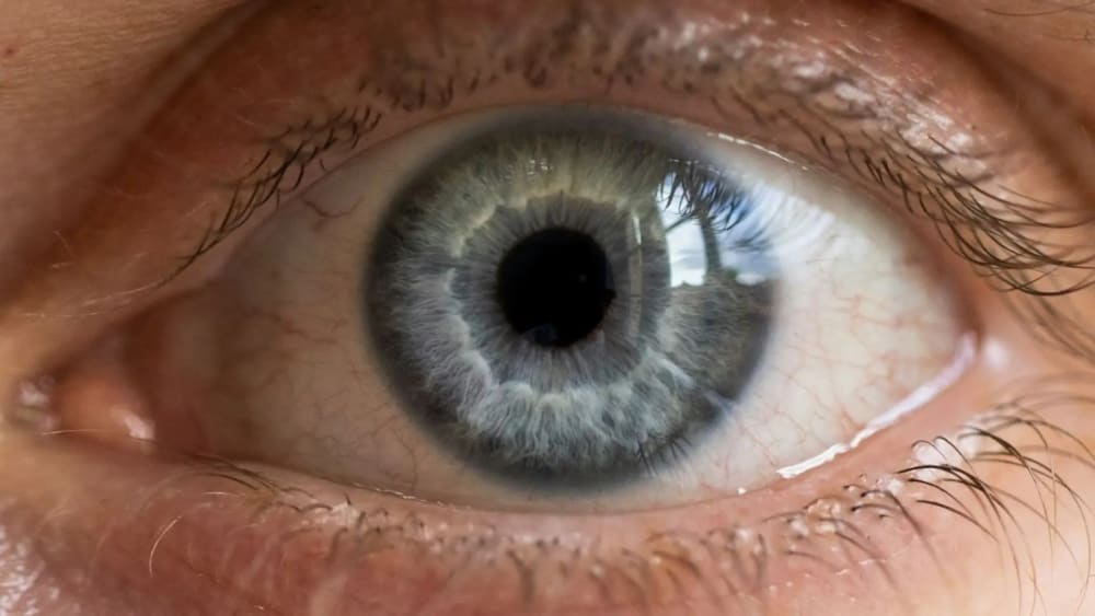 Els metges descobreixen un clau de 35 mil·límetres dins de l'ull d'un home que havia perdut la visió