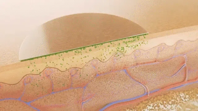 Illustration de l'absorption transdermique d'un patch à travers la peau