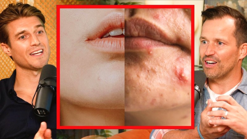Acne and Leaky Gut: The Gut-Skin Claims, Examined Closely