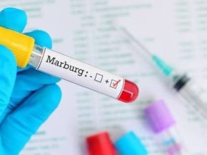 Истринский территориальный отдел Управления Роспотребнадзора по Московской области обращает внимание